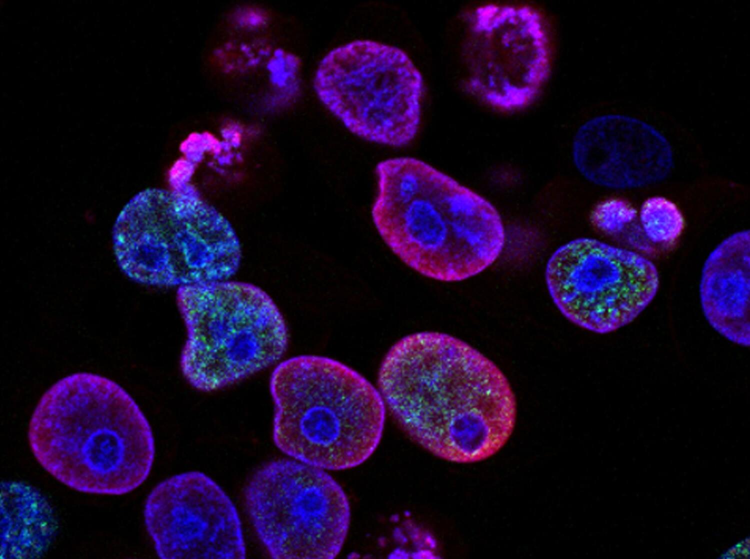 image of bacteria analysed
